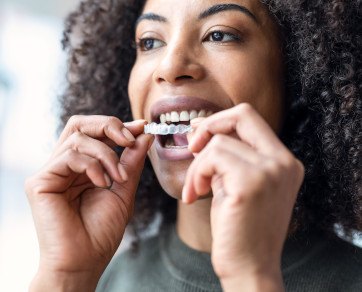 Woman about to wear a ClearCorrect clear aligner in Forth Worth, TX